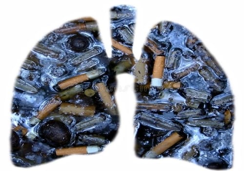 Lungs of smokers