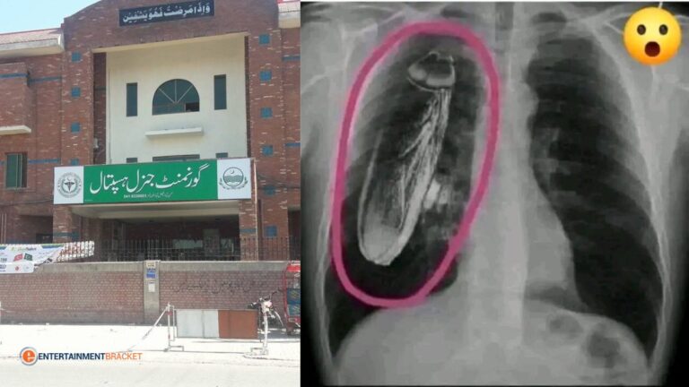 X-ray Showing a Live Cockroach in a Patient Chest